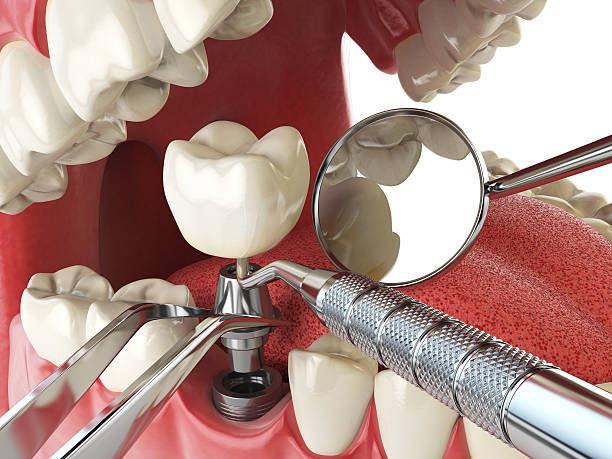 Best Mobile Emergency Dentist in Eden, NC